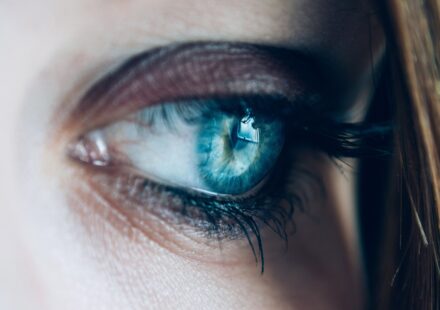 cat eyes dilated pupil